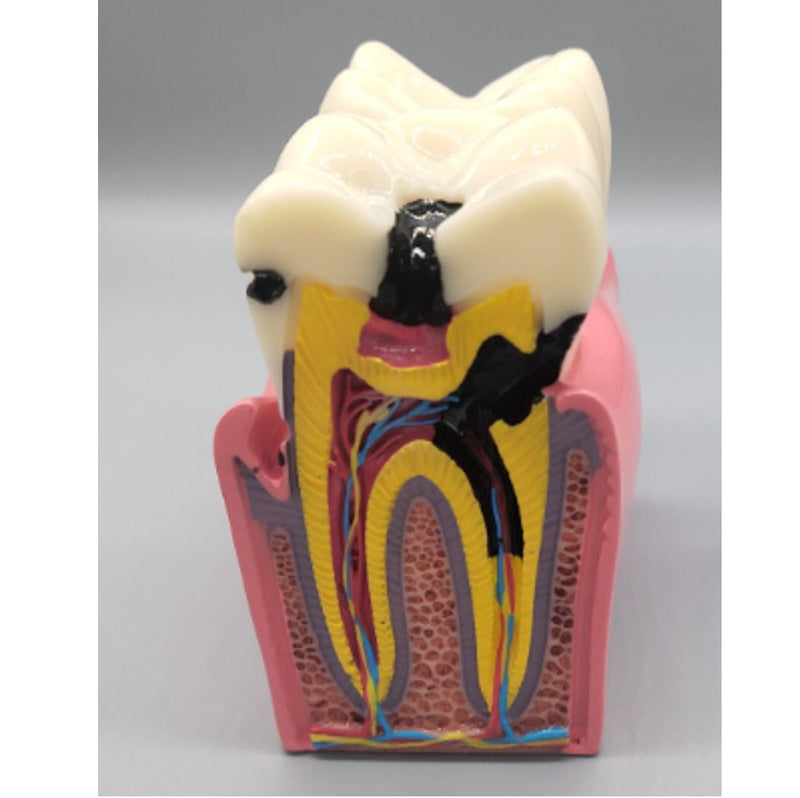 Double Teeth Model Double Teeth Model