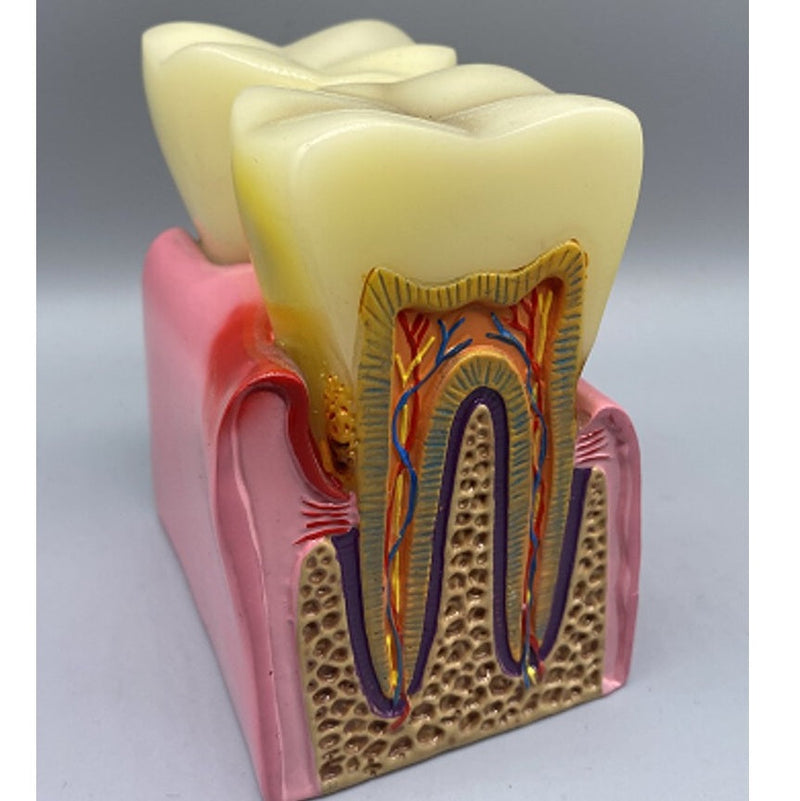 Double Teeth Model US Double Teeth Model US