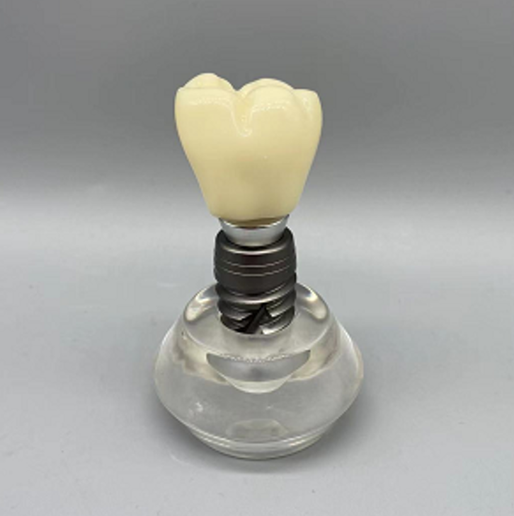 Dental Implant Educational Model (Copy) Dental Implant Educational Model (Copy)