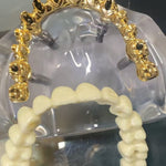 Aesthetic Bridge 4 Implant Aesthetic Bridge 4 Implant