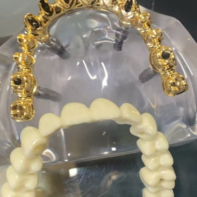 Aesthetic Bridge 4 Implant Aesthetic Bridge 4 Implant