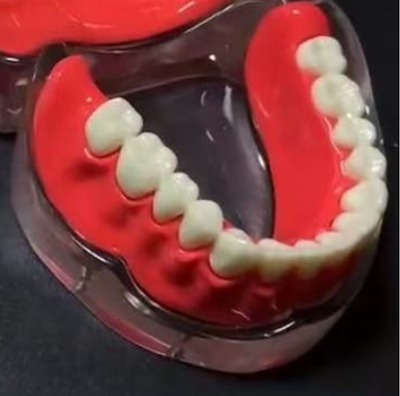 Implant Model Full Mouth Denture Mandible or Maxilla Implant Model Full Mouth Denture Mandible or Maxilla