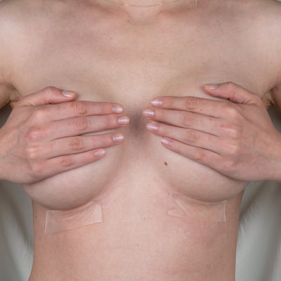 Advanced Medical-Grade Silicone 1" x 3" Strips for Smaller Scars - Now includes Adhesive Tape for Longer Hold! Advanced Medical-Grade Silicone 1" x 3" Strips for Smaller Scars - Now includes Adhesive Tape for Longer Hold!