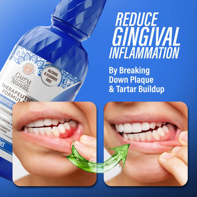 Healthy Gums Oral Rinse, Wild Mint Healthy Gums Oral Rinse, Wild Mint