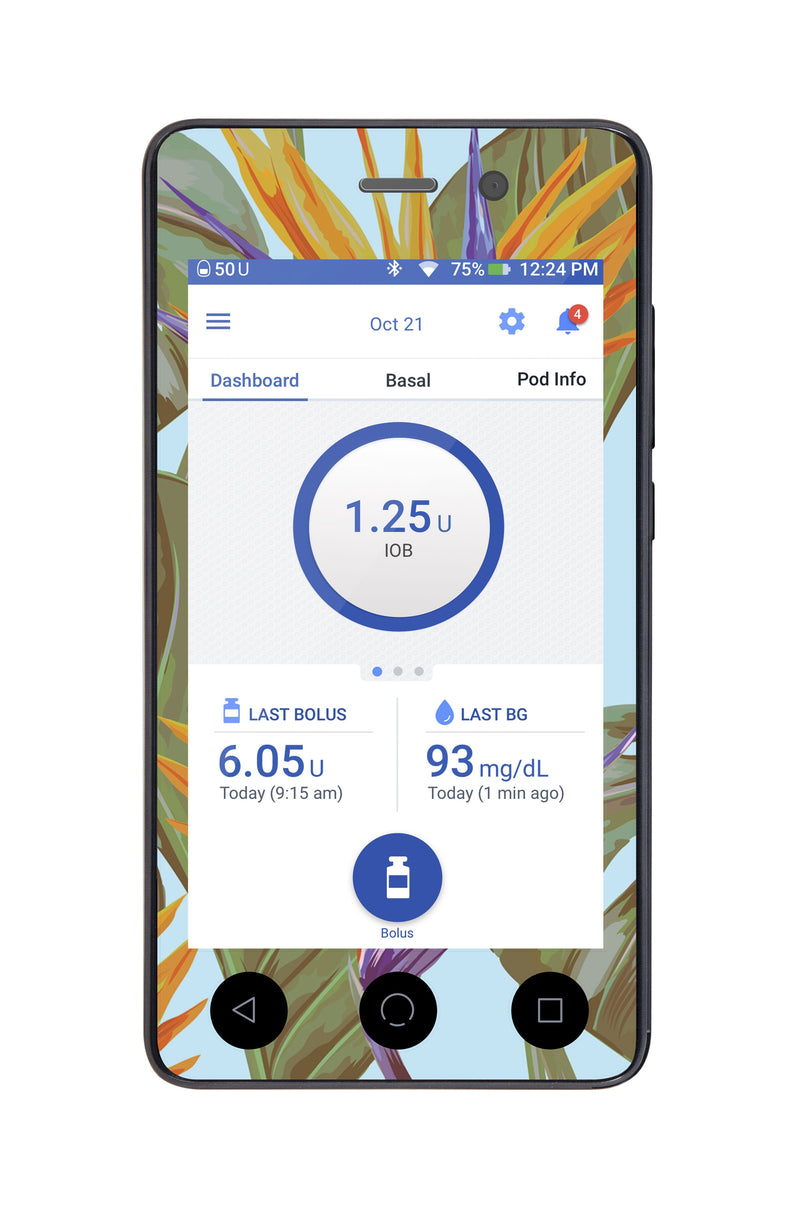 Birds of Paradise Sticker for Omnipod DASH® PDM – Pump Peelz Birds of Paradise Sticker for Omnipod DASH® PDM – Pump Peelz