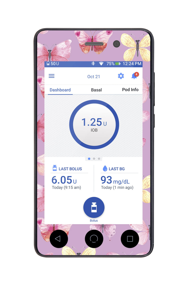 Butterflies Sticker for Omnipod DASH® PDM – Pump Peelz Butterflies Sticker for Omnipod DASH® PDM – Pump Peelz