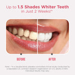 Sensitive Whitening Strips Sensitive Whitening Strips