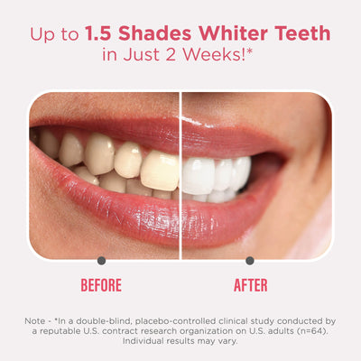 Sensitive Whitening Strips Sensitive Whitening Strips