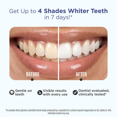 Whitening Strips Whitening Strips