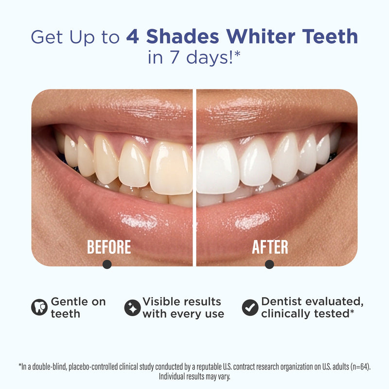 Whitening Strips Whitening Strips