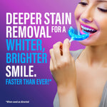 Wired LED Teeth Whitening Kit Wired LED Teeth Whitening Kit
