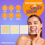 Wired LED Teeth Whitening Kit Wired LED Teeth Whitening Kit