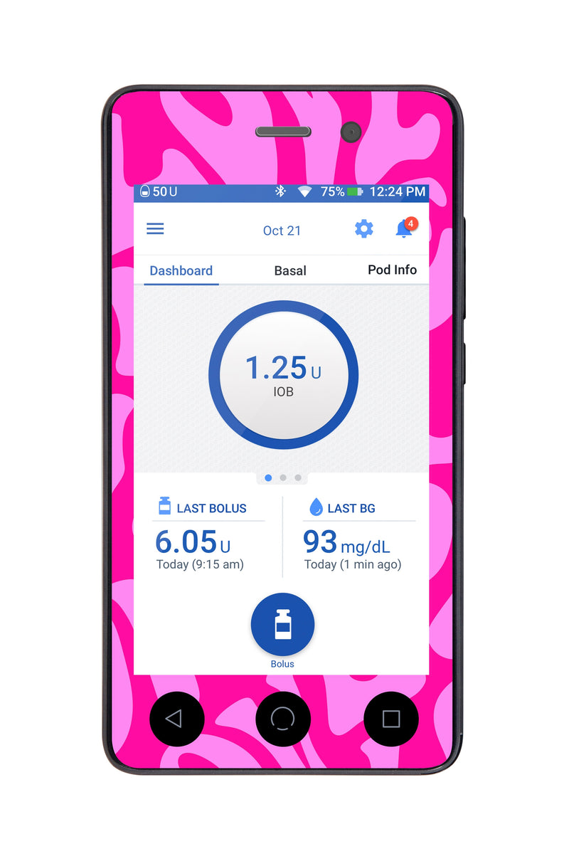 Love Sticker for Omnipod DASH® PDM – Pump Peelz Love Sticker for Omnipod DASH® PDM – Pump Peelz