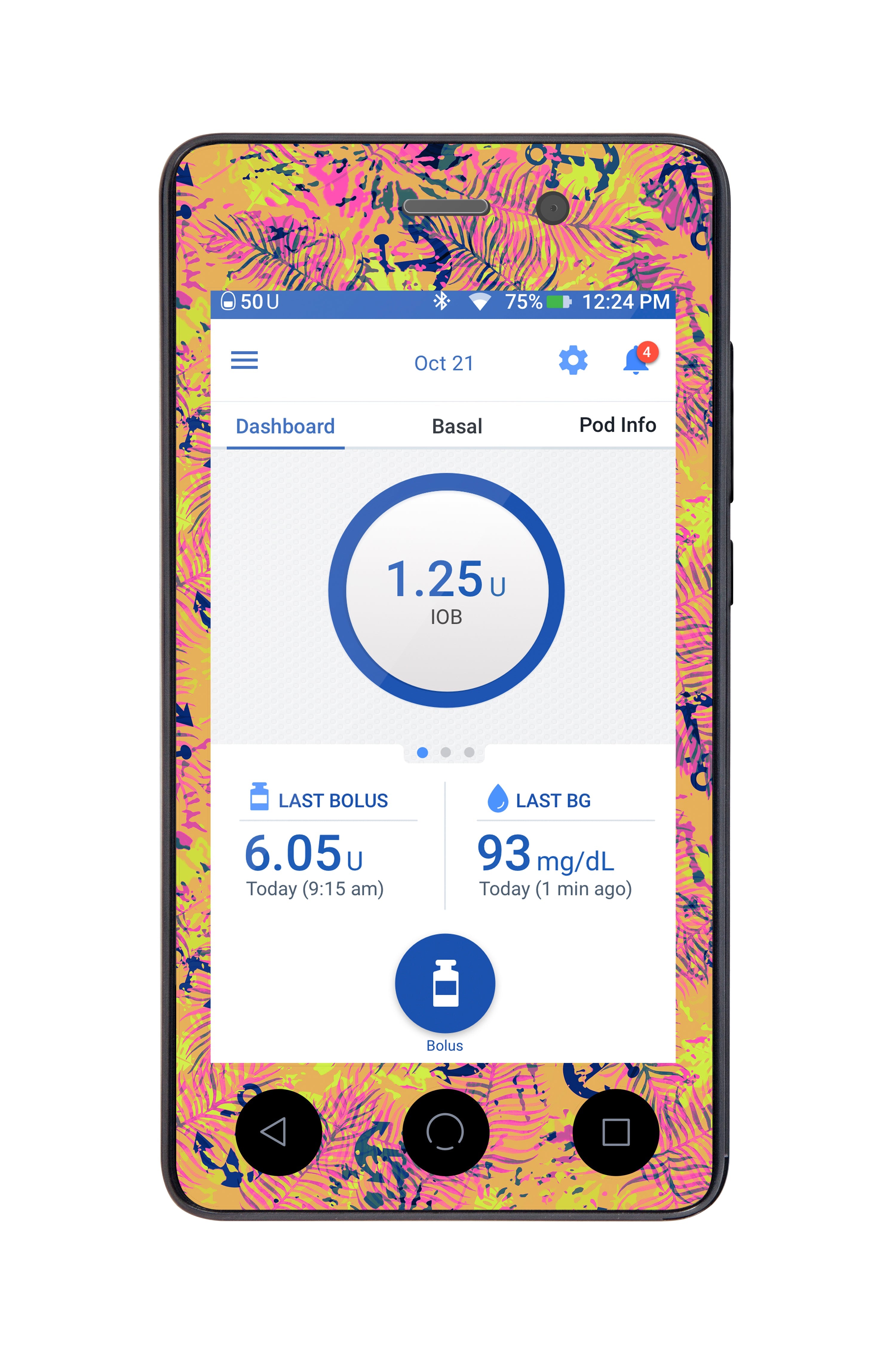 Electric Island Sticker for Omnipod DASH® PDM – Pump Peelz Electric Island Sticker for Omnipod DASH® PDM – Pump Peelz