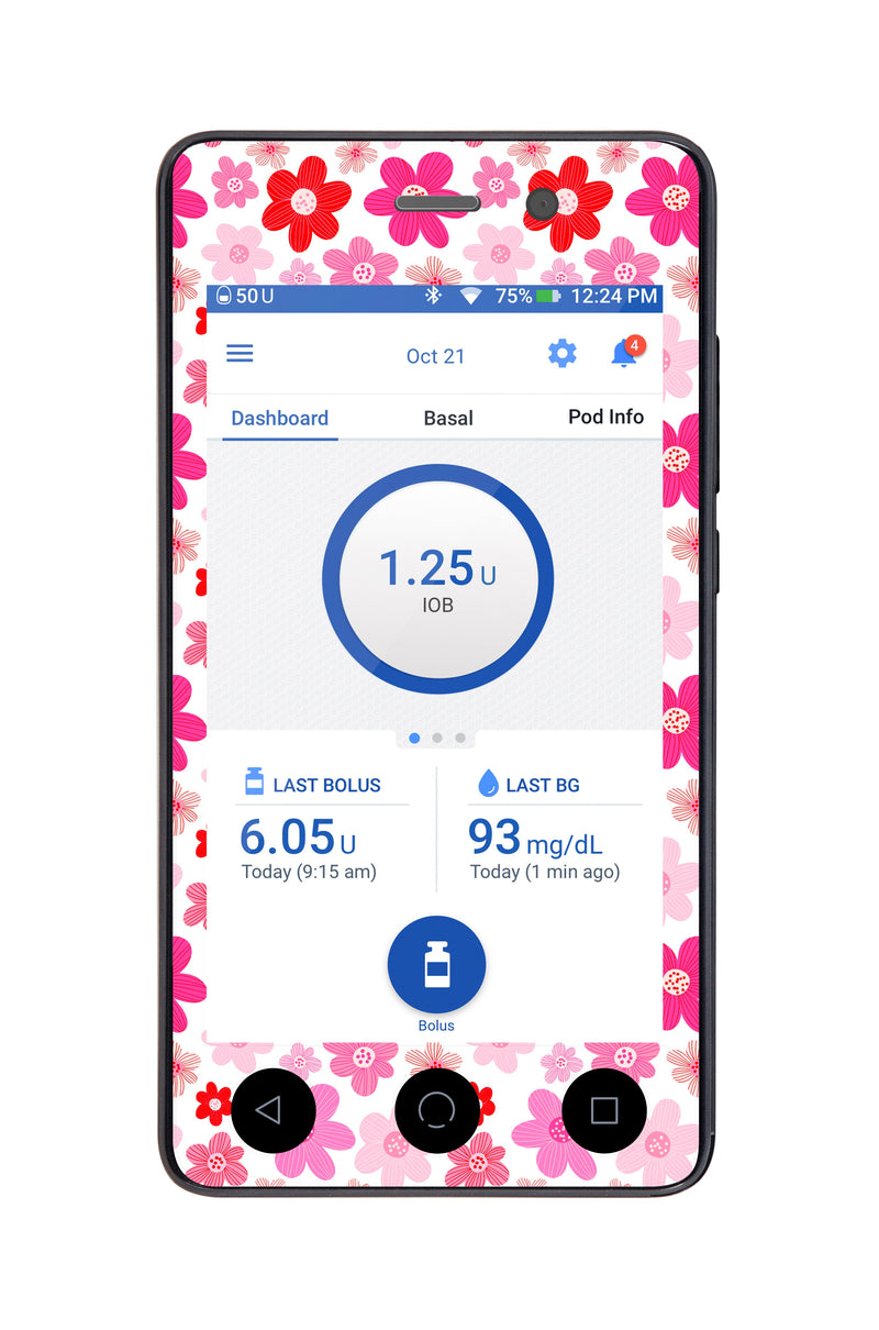 Fresh Start Sticker for Omnipod DASH® PDM – Pump Peelz Fresh Start Sticker for Omnipod DASH® PDM – Pump Peelz