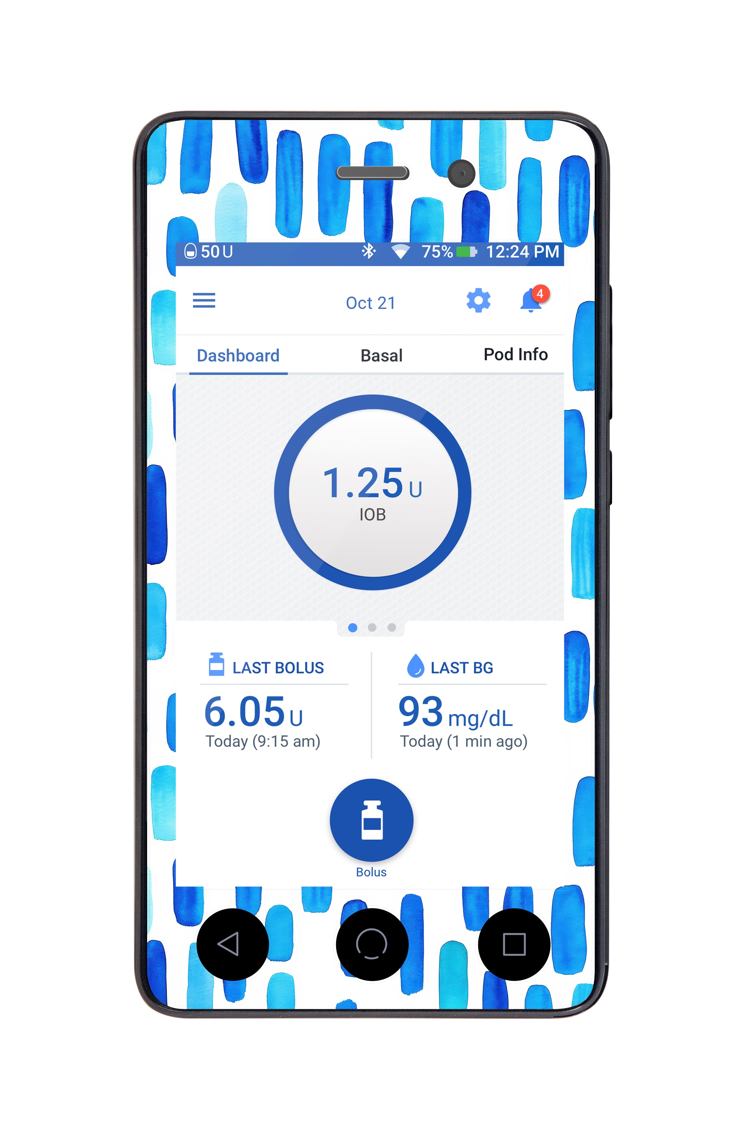 Level Lines Sticker for Omnipod DASH® PDM – Pump Peelz Level Lines Sticker for Omnipod DASH® PDM – Pump Peelz
