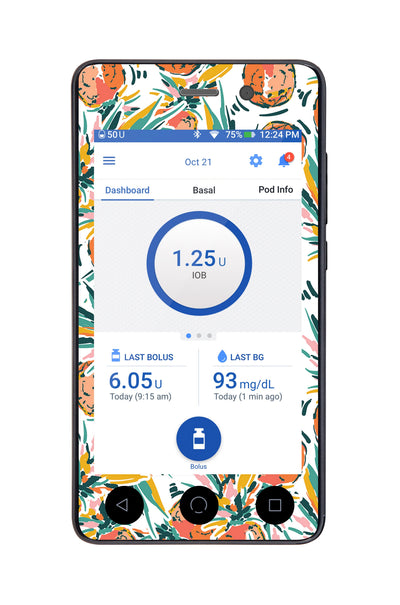 Pineapple Paradise Sticker for Omnipod DASH® PDM – Pump Peelz Pineapple Paradise Sticker for Omnipod DASH® PDM – Pump Peelz