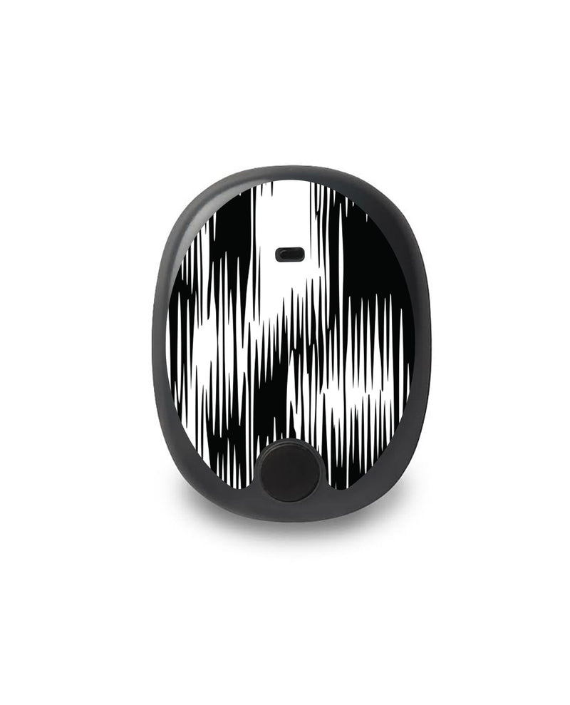 Static Interference Eversense Smart Transmitter Static Interference Eversense Smart Transmitter