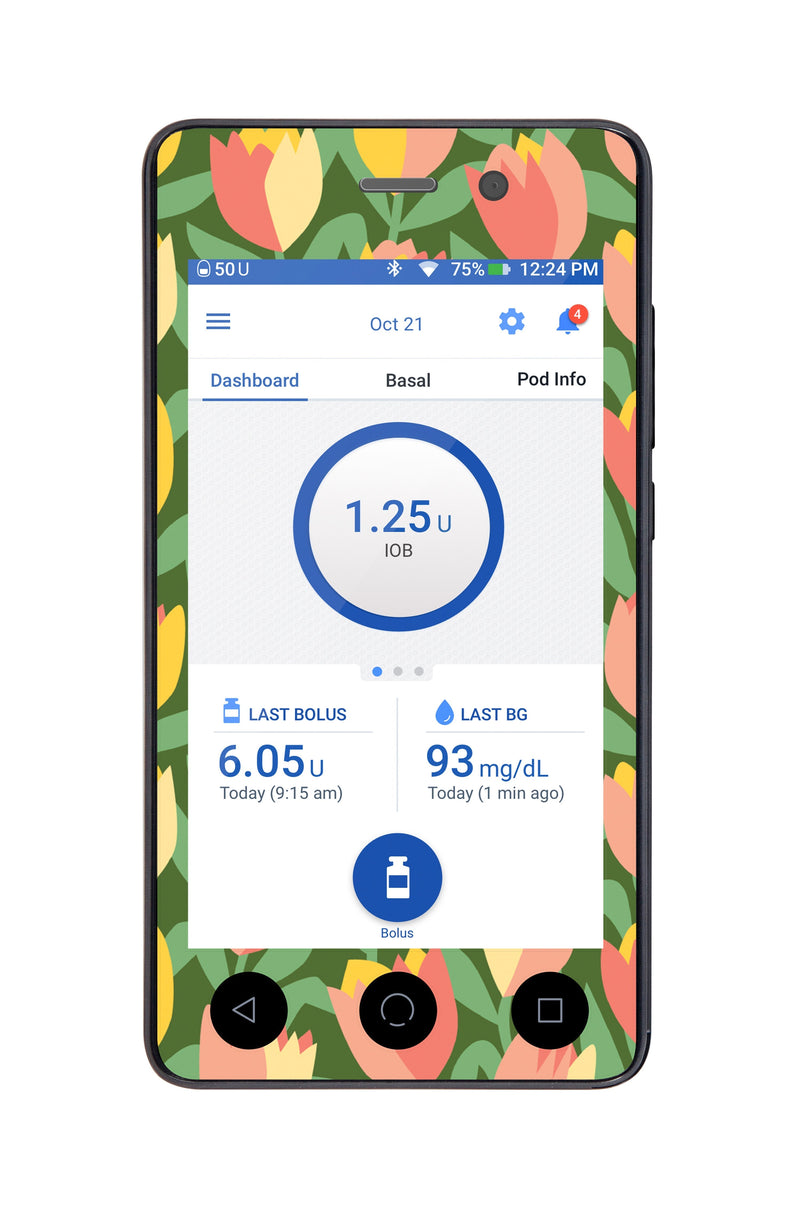 Tons Of Tulips Sticker for Omnipod DASH® PDM – Pump Peelz Tons Of Tulips Sticker for Omnipod DASH® PDM – Pump Peelz