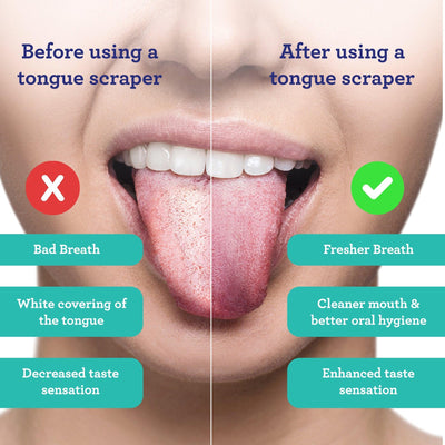 U Shaped Stainless Steel Tongue Scraper – 2 Pack U Shaped Stainless Steel Tongue Scraper – 2 Pack