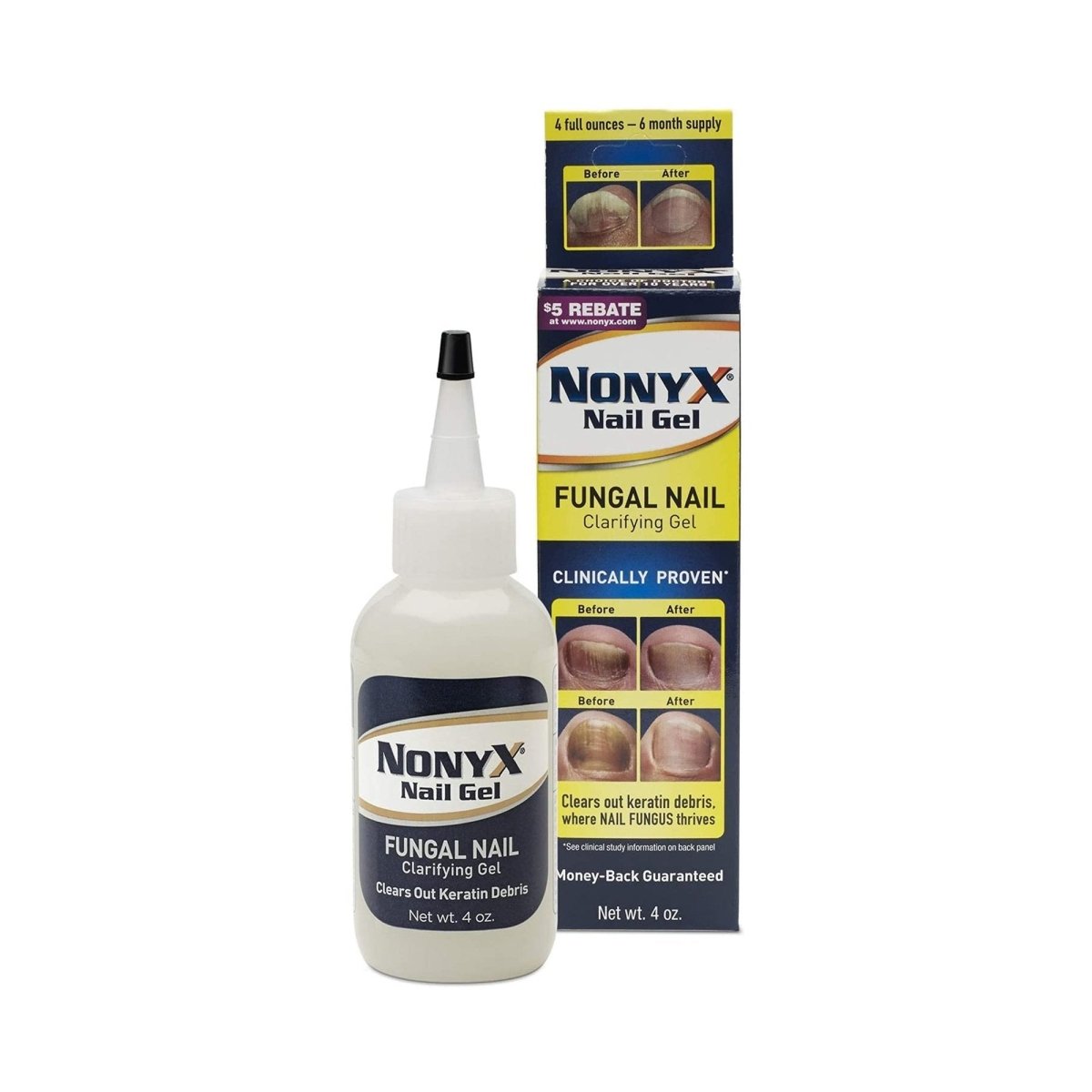 Nonyx Ethanoic Acid Antifungal - 1105892_EA - 1 Nonyx Ethanoic Acid Antifungal - 1105892_EA - 1