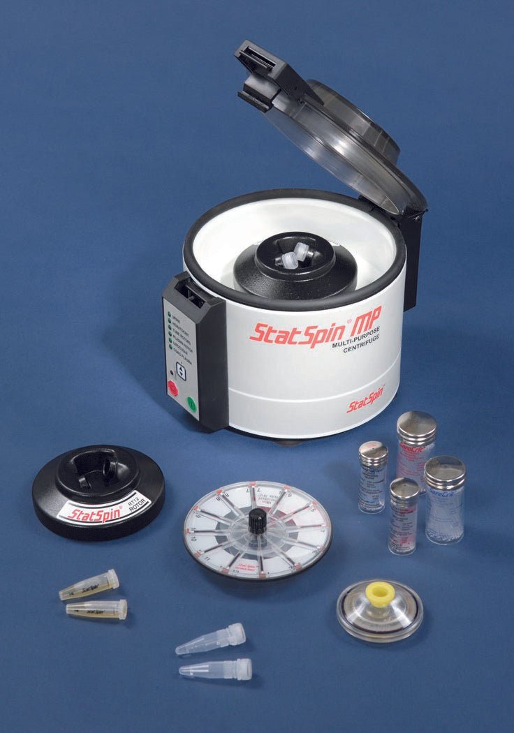 StatSpin Precalibrated Urine Tube - 195841_CT - 2 StatSpin Precalibrated Urine Tube - 195841_CT - 2