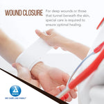 Dynarex Packing Strips Iodoform - Sterile, 12ea/cs (12 Count)