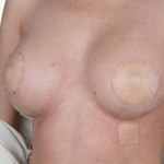 Advanced Medical-Grade Silicone Breast Lollypop Sheet - Now includes Adhesive Tape for Longer Hold!