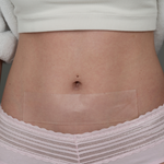 Advanced Medical-Grade 2" X 8" Strip - Now includes Adhesive Tape for Longer Hold!