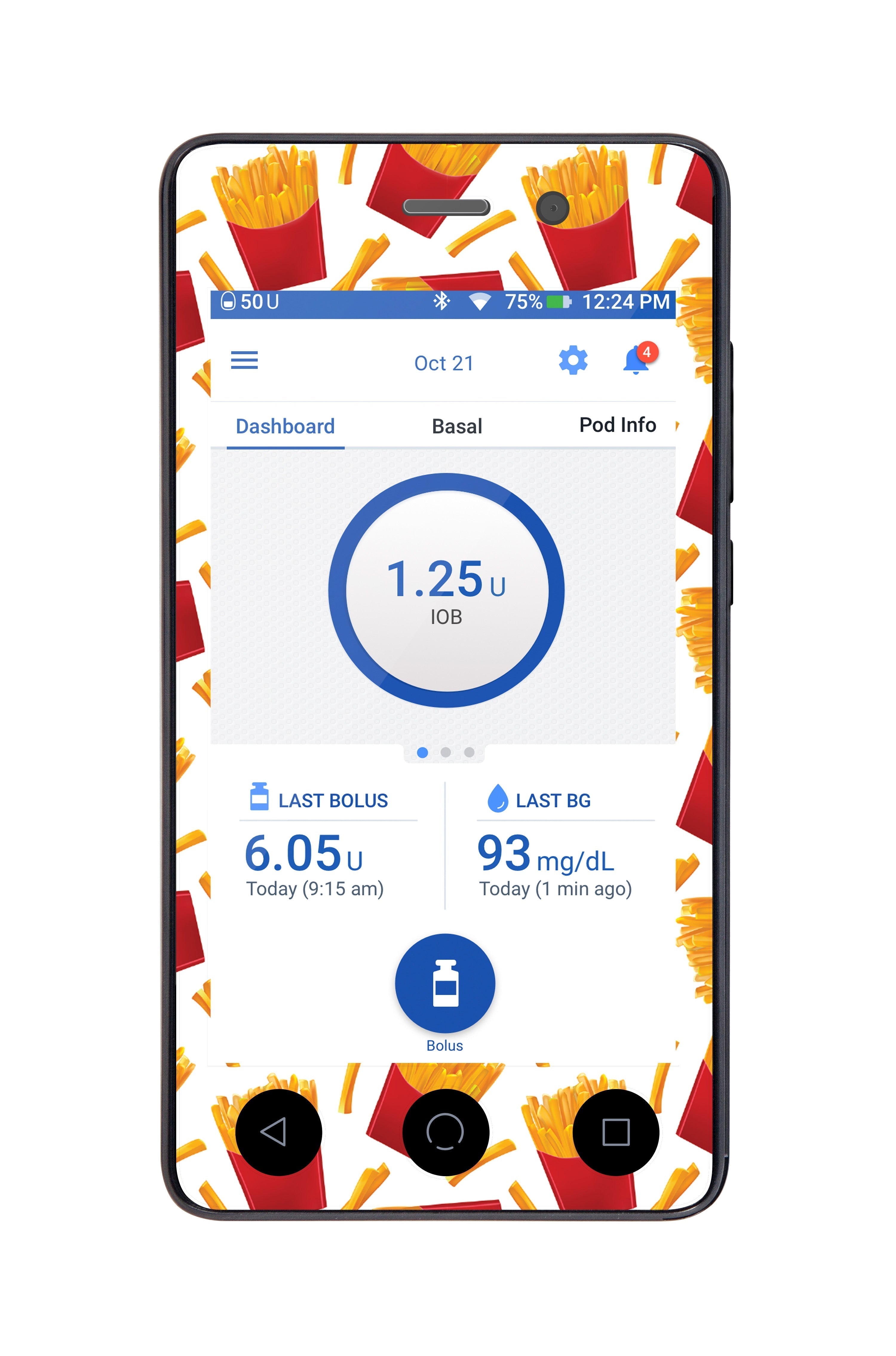 French Fries Sticker for Omnipod DASH® PDM – Pump Peelz