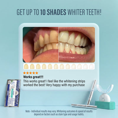 Wireless LED Teeth Whitening Kit