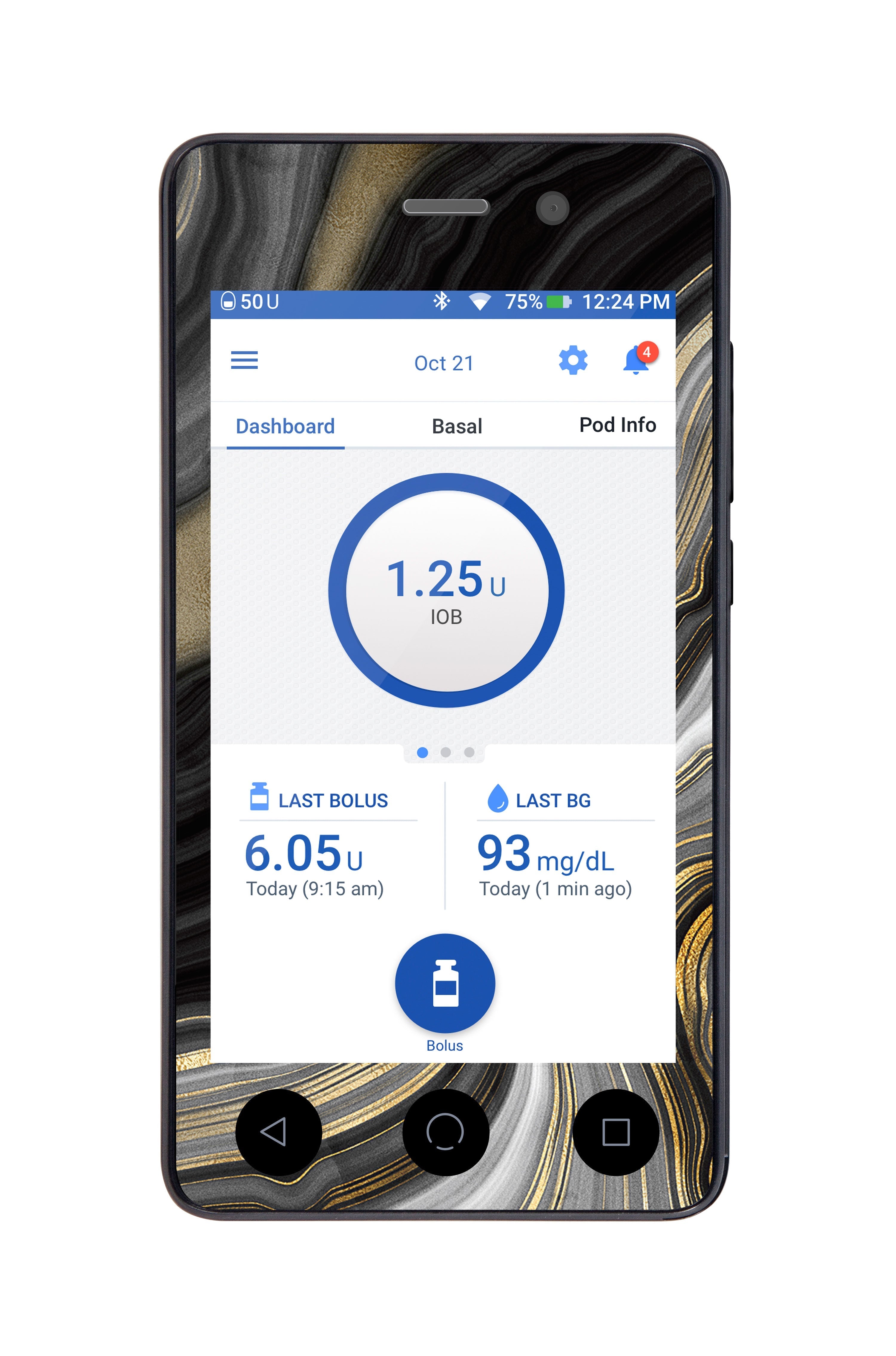 Gold Marble Sticker for Omnipod DASH® PDM – Pump Peelz