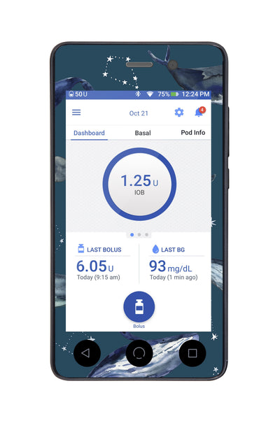 Midnight Whales Sticker for Omnipod DASH® PDM – Pump Peelz