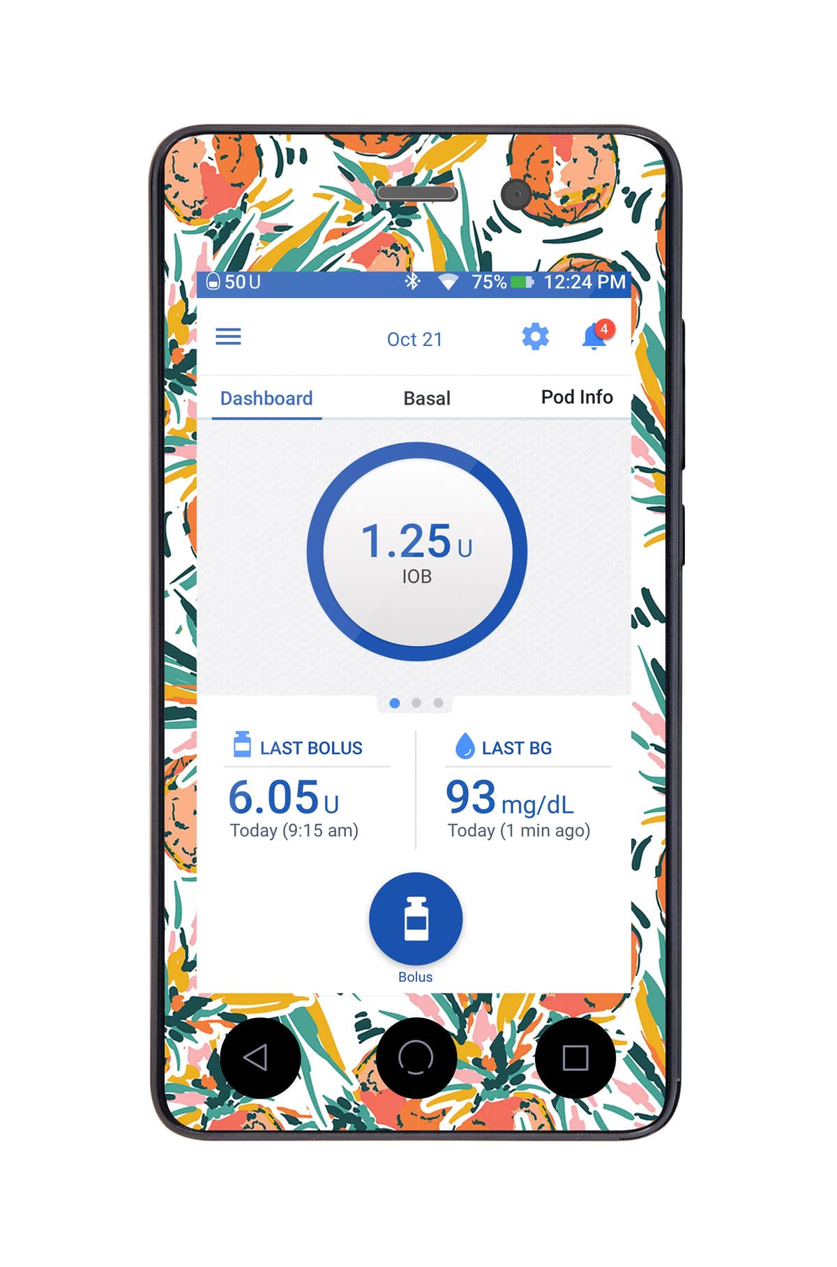 Pineapple Paradise Sticker for Omnipod DASH® PDM – Pump Peelz