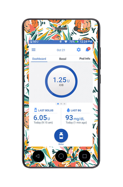 Pineapple Paradise Sticker for Omnipod DASH® PDM – Pump Peelz