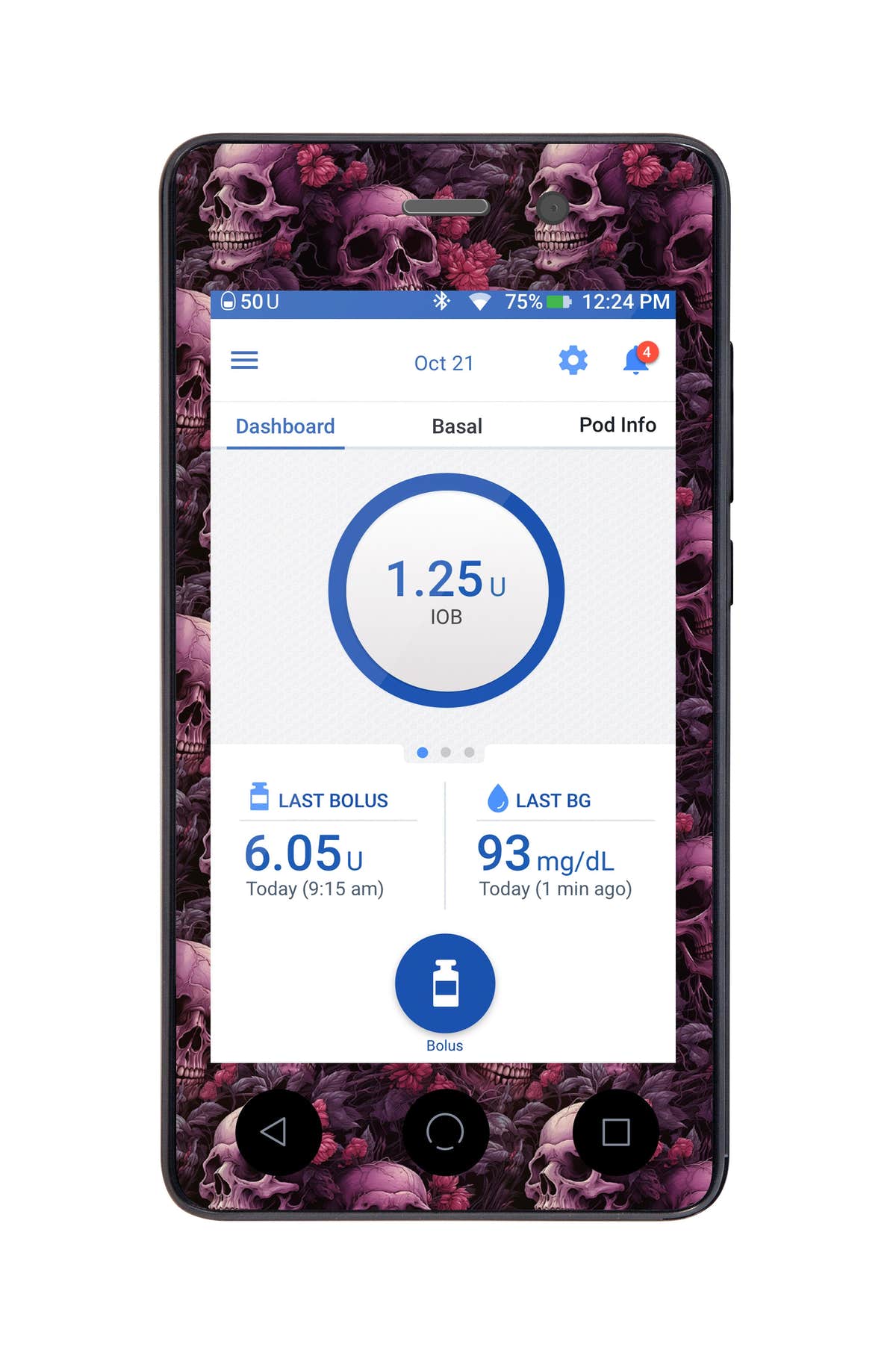 Pink Skulls Sticker for Omnipod DASH® PDM – Pump Peelz