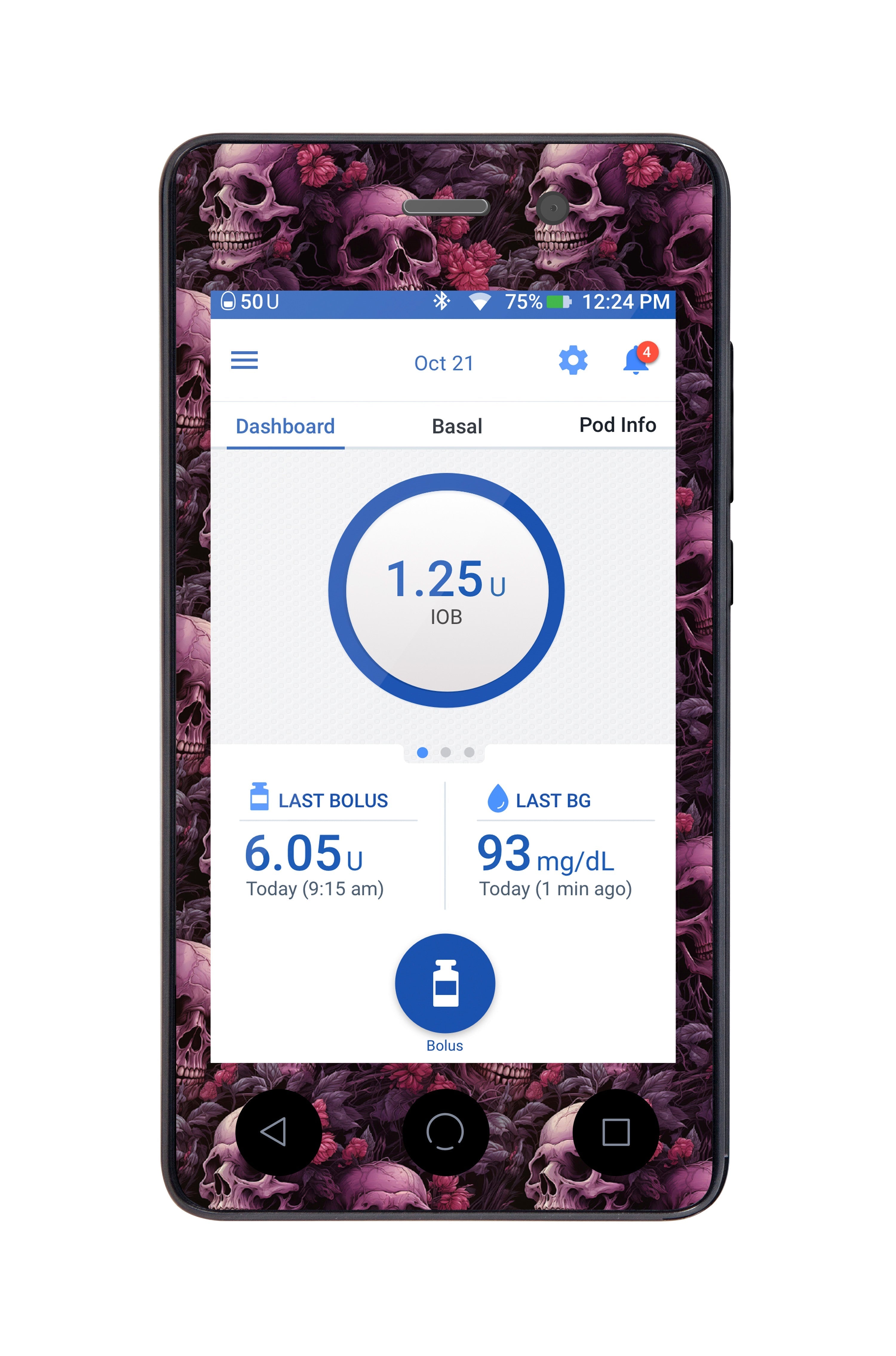Pink Skulls Sticker for Omnipod DASH® PDM – Pump Peelz