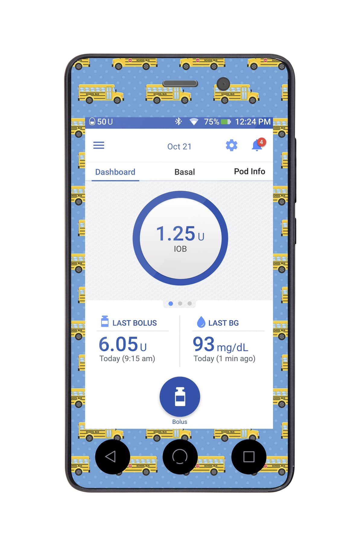 School Bus Sticker for Omnipod DASH® PDM – Pump Peelz