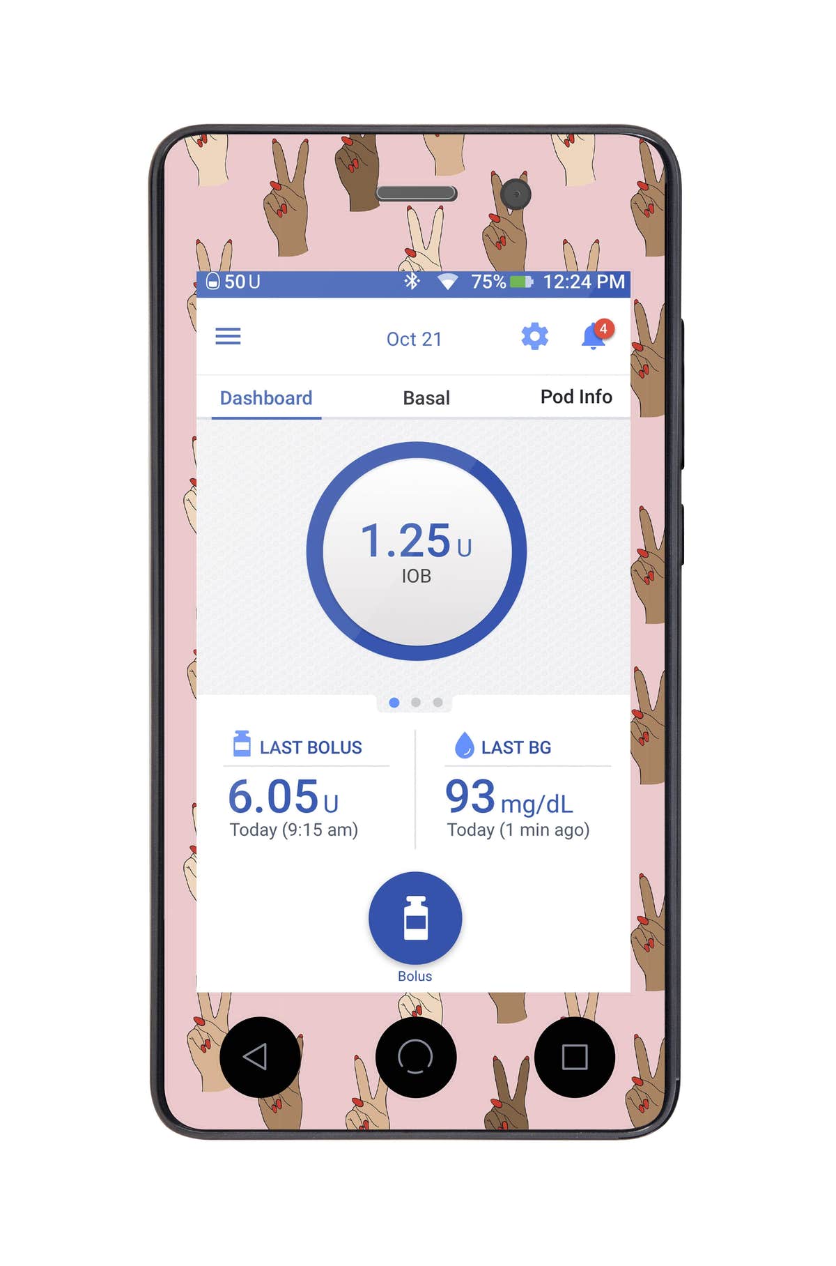 Together Sticker for Omnipod DASH® PDM – Pump Peelz