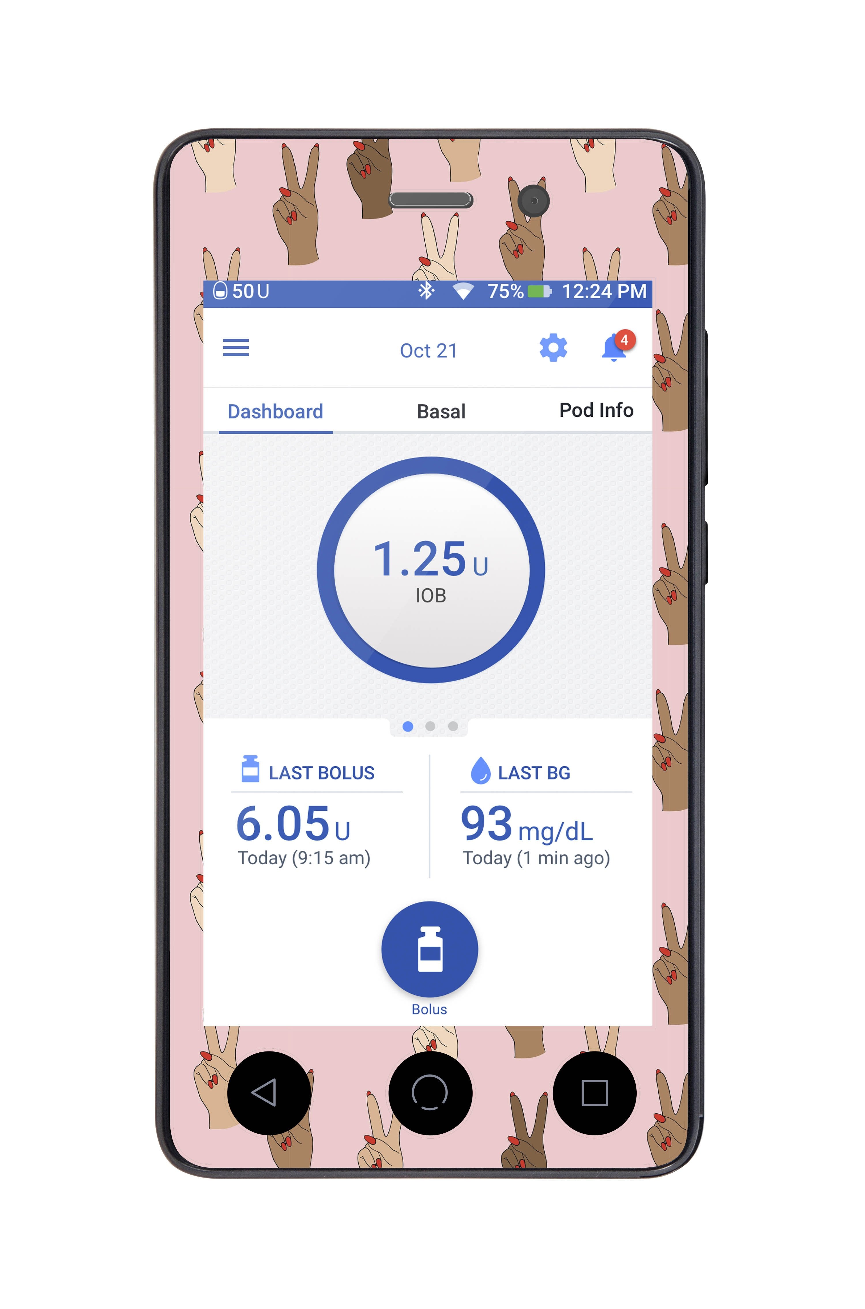Together Sticker for Omnipod DASH® PDM – Pump Peelz