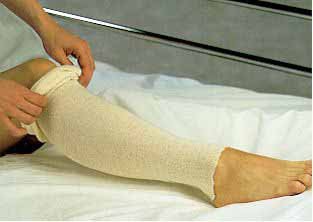 Albahealth Natural Cotton Tubular Stockinette - 243650_CS - 2