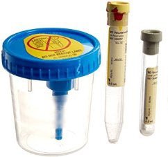 BD® Vacutainer® Urine Specimen Collection Kit - 492909_CS - 2