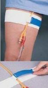 Cath Mate Ii Leg Stap - 345357_EA - 1
