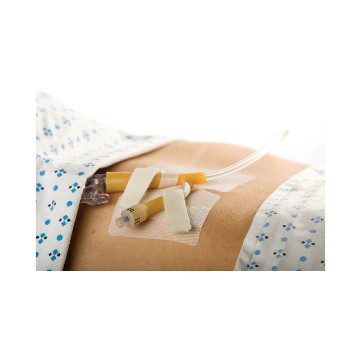 Cath Secure Dual Tab Catheter Holder - 785700_BX - 1