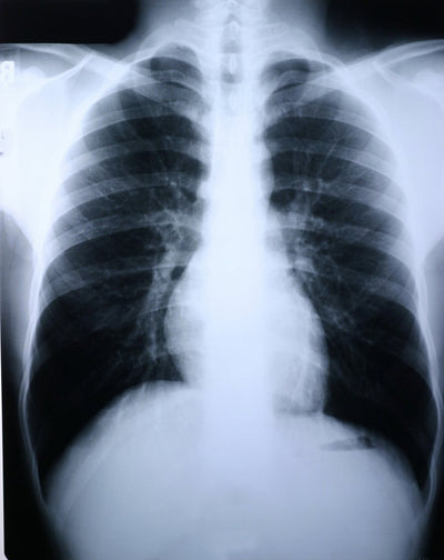 Clear Choice Performance X Ray Film - 456489_BX - 2